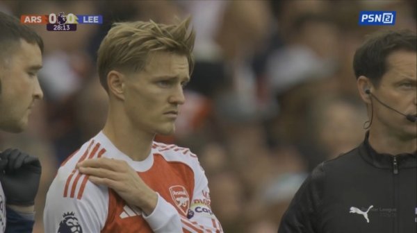 Odegao was brought down by Leeds United player and suspected of being injured in his right shoulder. The team doctor can still hold on to the game after examination.